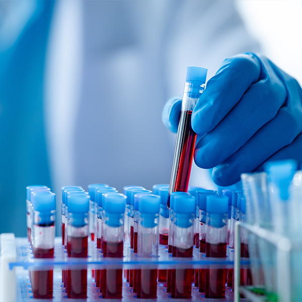 Schedule Your Complete Blood Panel Today