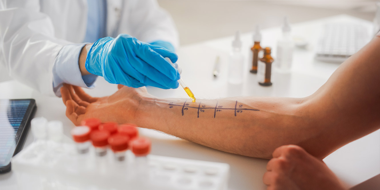 Allergy Testing