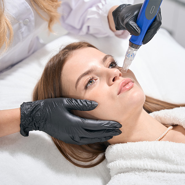 Vampire Facial PRP plus Microneedling