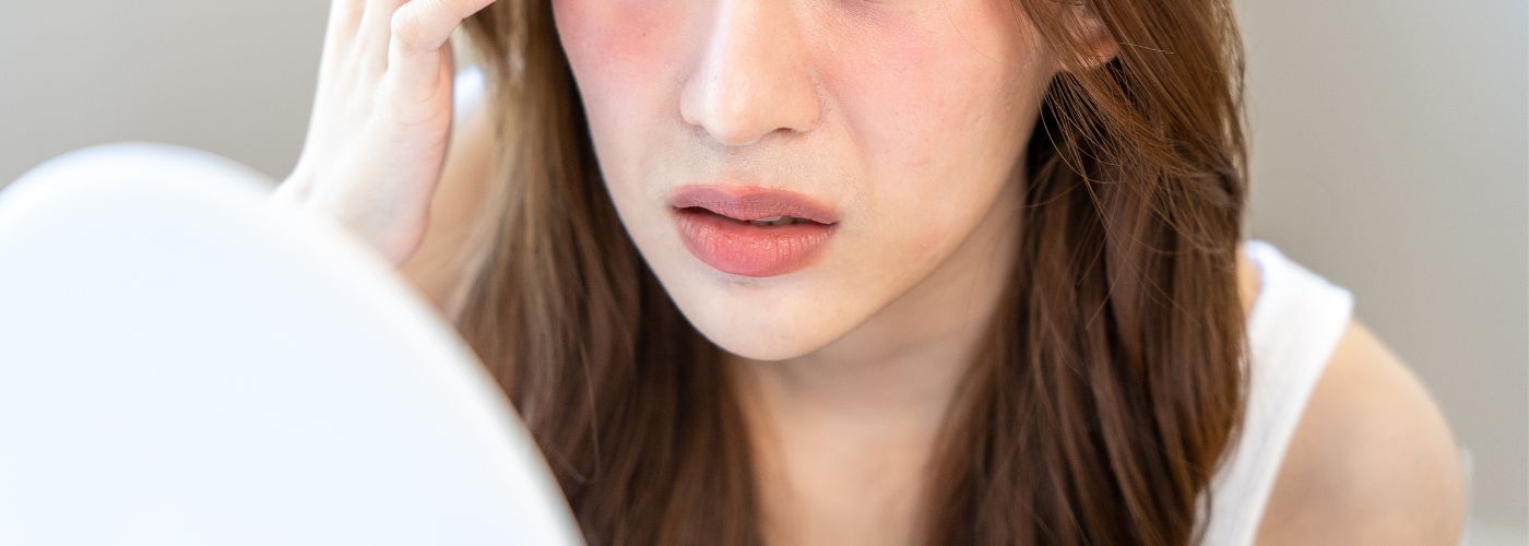 Can You Use Exosome Therapy for Skin Damage