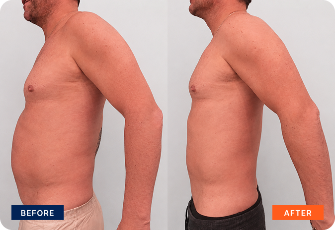 img-body-contour-4