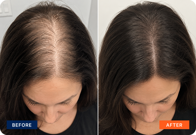 img-exosome-hair-5