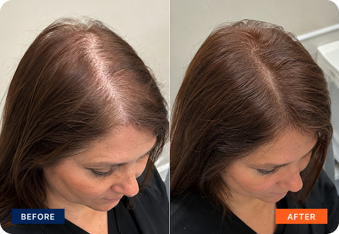 img-exosome-hair-6
