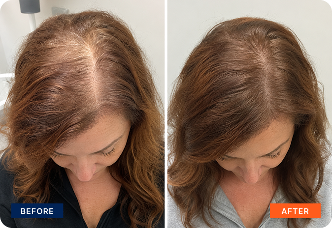 img-exosome-hair-8