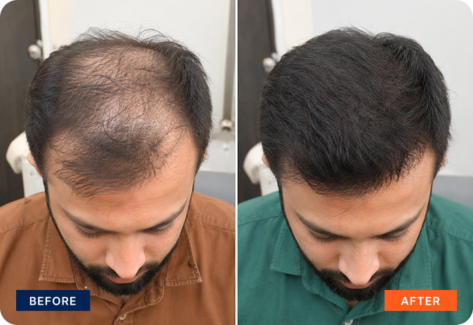 img-stem-cell-hair-8