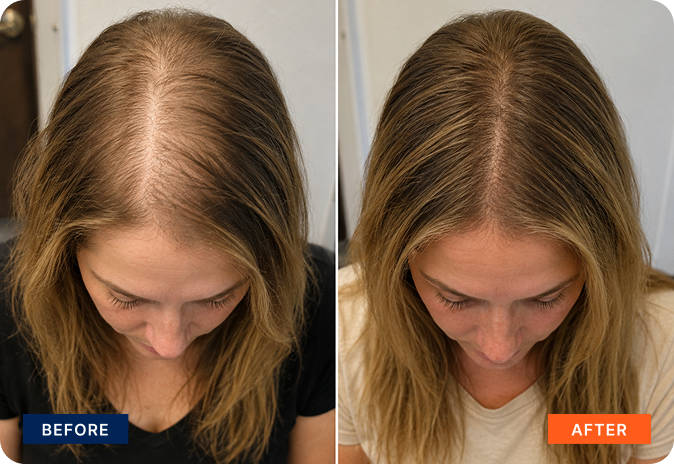 img-stem-cell-hair-9